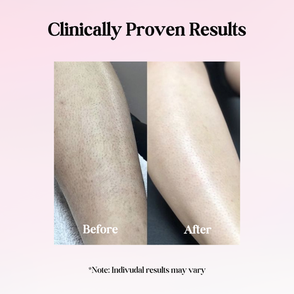 Cypra Beauty - Cyperus Rotundus Oil for Permanent Hair Reduction