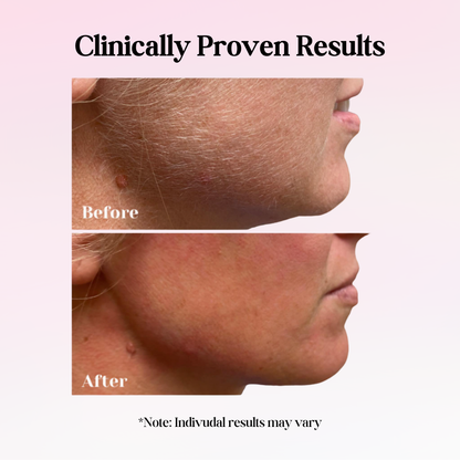 Cypra Beauty - Cyperus Rotundus Oil for Permanent Hair Reduction