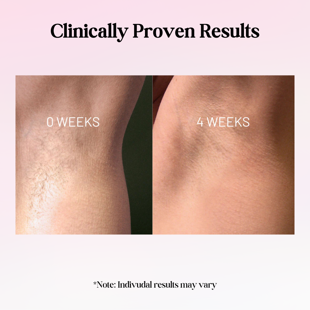 Cypra Beauty - Cyperus Rotundus Oil for Permanent Hair Reduction